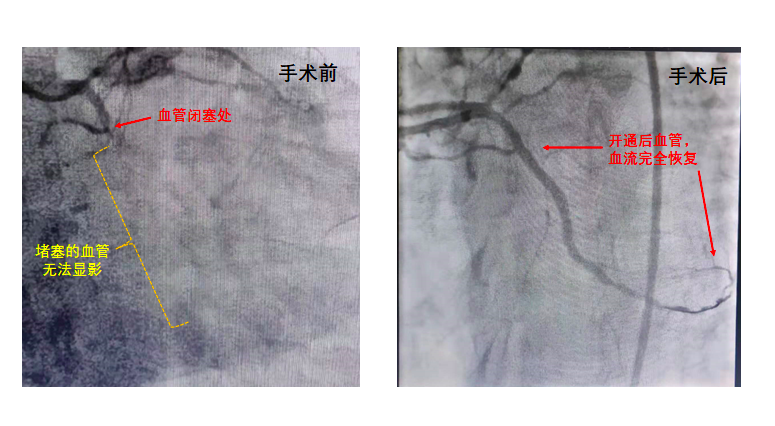 屏幕快照 2022-03-17 下午6.01.58.png